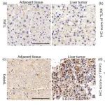 港城大杨梦甦团队《Oncogene》：利用血液剪切力区分高转移潜力的循环肿瘤细胞