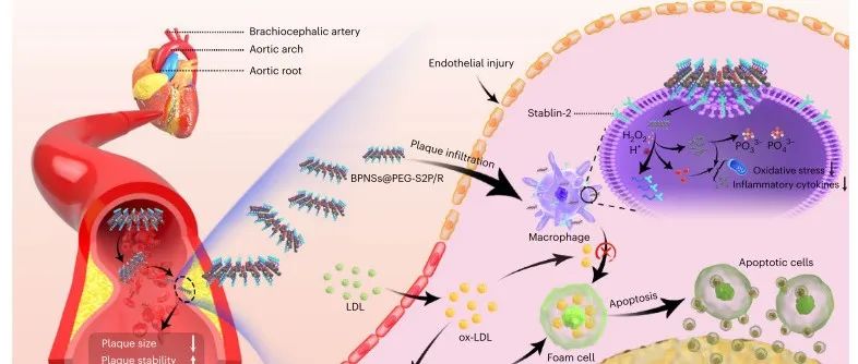 Nature Nanotechnology 丨 利用抗氧化性黑磷纳米片向皮损巨噬细胞传递解决素D1治疗动脉粥样硬化