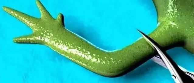 人类为什么不进化出断肢再生的能力?