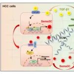 STTT | 南京医科大学张业伟团队发现Sema3C重塑基质微环境以促进肝细胞癌进展