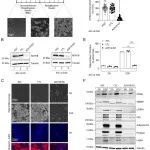 PNAS | 醇脱氢酶ADH1B作为内源性9-cis RA的关键来源，在人类脂肪生成中发挥重要作用