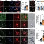 Adv Sci丨同济大学熊利泽/田莉/胡霁合作发现小胶质细胞Clec7a在缺血性中风中的作用机理