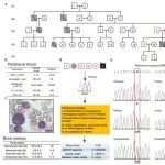 Nat Commun | 中国医学科学院石莉红/竺晓凡揭示TLR8在红系细胞内的激活影响遗传性贫血患者的红细胞生成