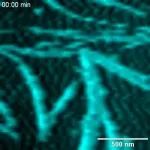 研究前沿：踏车细丝-自组装 | Nature Physics